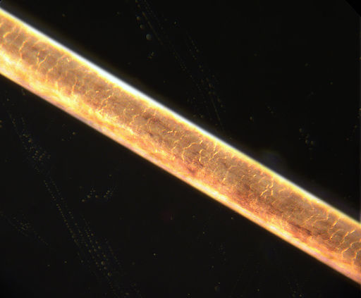 Hair Under The Microscope Compound And Stereo Microscope Observations