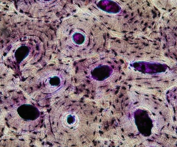 bone cells under microscope