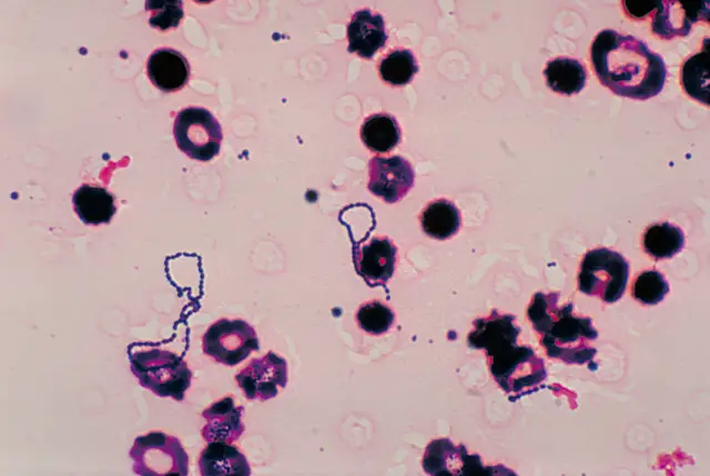 Streptococcal Bacteria