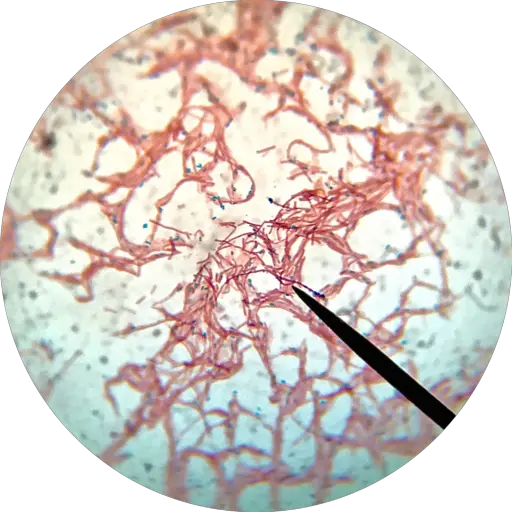 Endospore Stain Definition Techniques Procedures And Significance