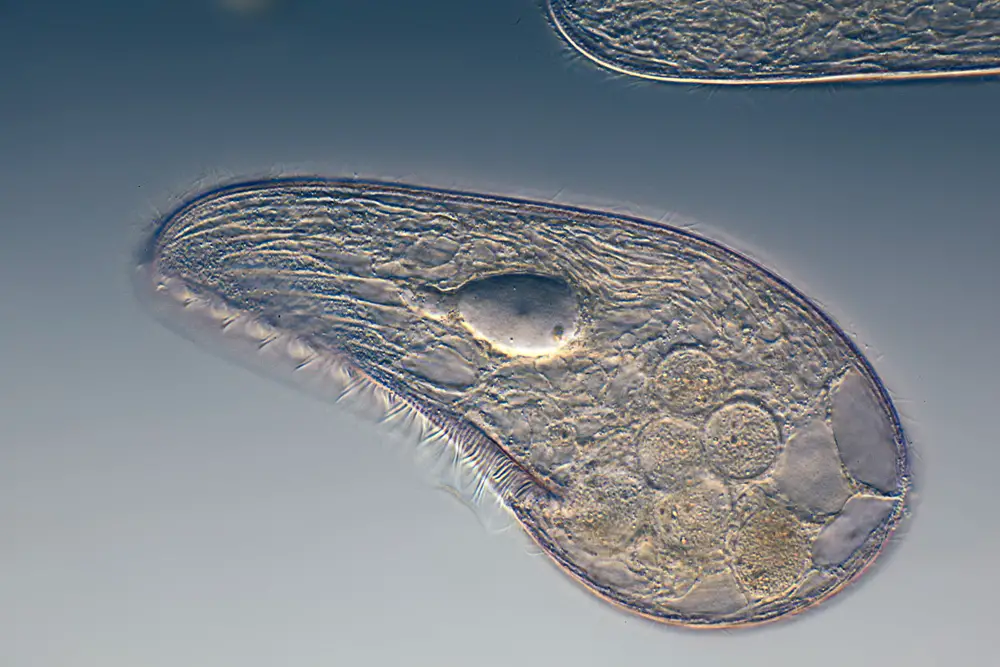 Microorganisms Taking A Look At Pond Water Organisms And More 